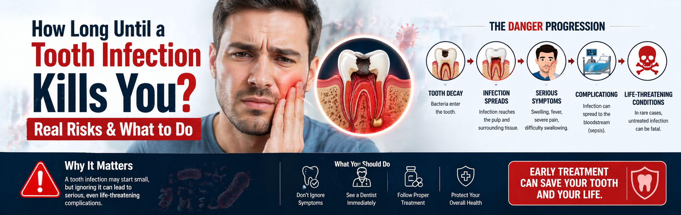 How Long Until a Tooth Infection Kills You?